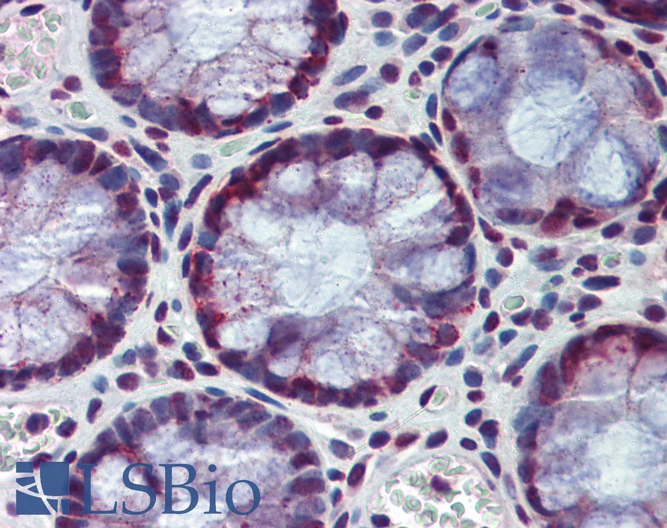 IHC-plus™ Polyclonal Rabbit anti-Human HDAC1 Antibody (IHC, IF, WB)