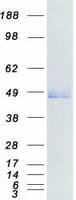 Human SIRT6 / Sirtuin 6 Protein (Recombinant Myc-DDK (Flag))
