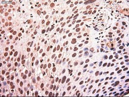 Monoclonal Mouse anti-Human MYC / c-Myc Antibody (clone OTI1A6, IHC, IF, WB)