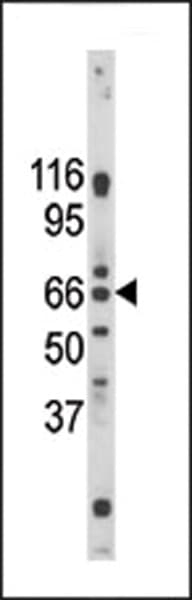 Polyclonal Rabbit anti-Human PAEL Receptor / GPR37 Antibody (aa217-246, IHC, WB)