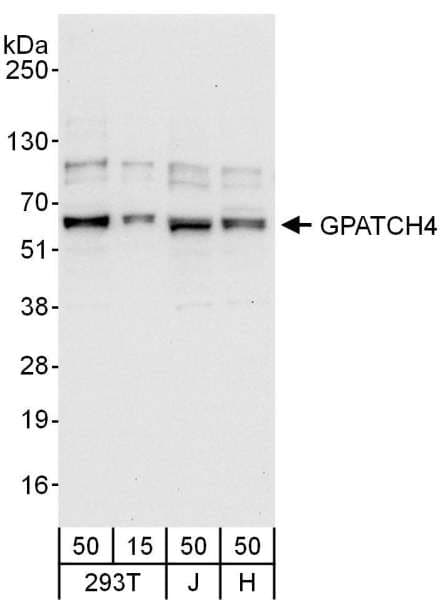 Polyclonal Rabbit anti-Human GPATCH4 Antibody (aa396-446, WB)