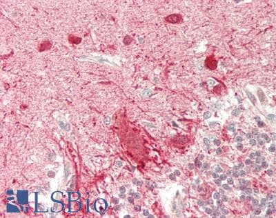 IHC-plus™ Polyclonal Rabbit anti-Human STXBP1 / MUNC18-1 Antibody (Internal, IHC, IF, WB)