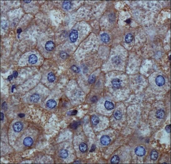 ENPP1 Antibody (Biotin)