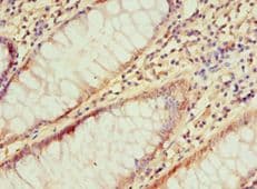 Polyclonal Rabbit anti-Human IRAK2 / IRAK-2 Antibody (aa1-270, IHC)