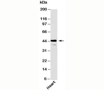 STRADB / ALS2CR2 Antibody