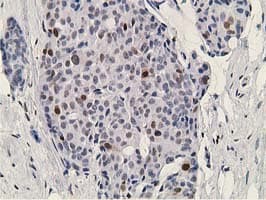 DCK / Deoxycytidine kinase Antibody (clone OTI16G6, Carrier-free)