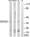 IHC-plus™ Polyclonal Rabbit anti-Human ZDHHC20 Antibody (aa72-121, IHC, WB)