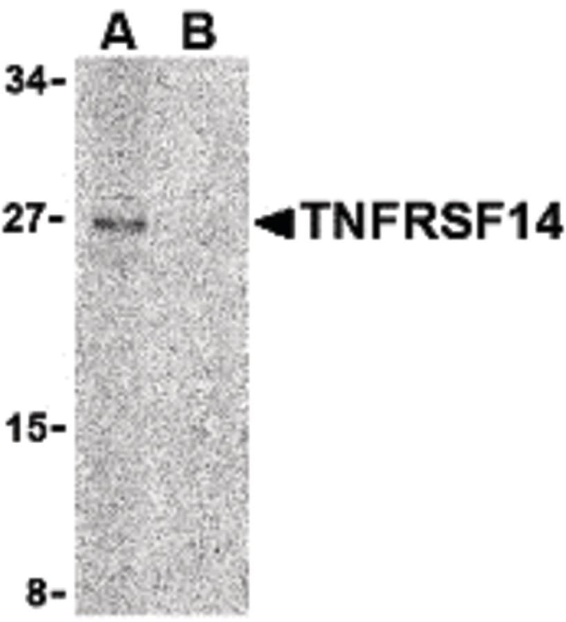 IHC-plus™ Polyclonal Rabbit anti-Human TNFRSF14 / CD270 / HVEM Antibody (IHC, IF, WB)