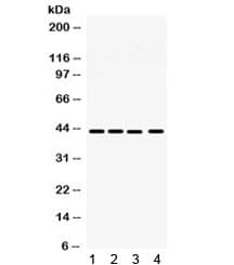 Polyclonal Rabbit anti-Human MICA Antibody (WB)