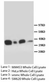 FOXL2 Antibody (N-Terminus)