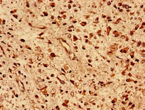 DNAJB5 Antibody