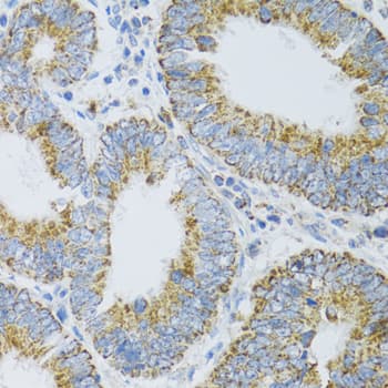 Polyclonal Rabbit anti-Human PDYN / ProDynorphin Antibody (IHC, WB)
