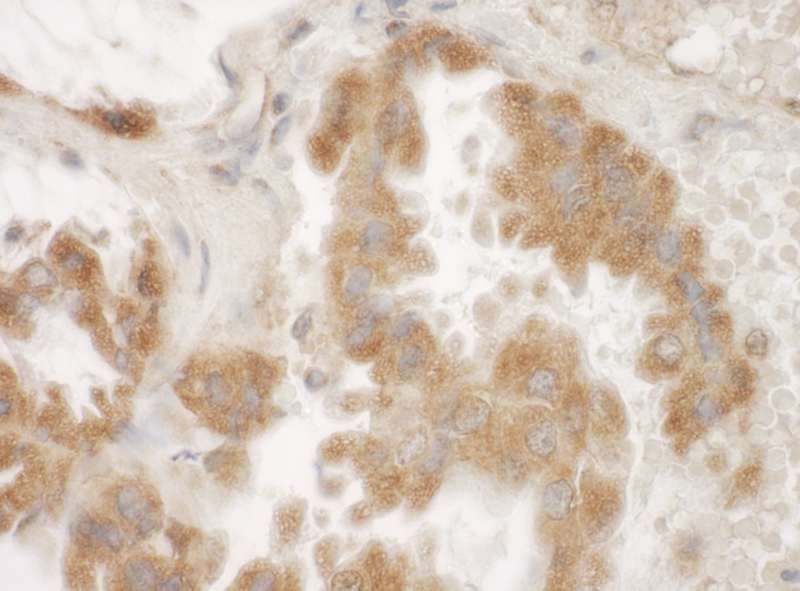 Polyclonal Rabbit anti-Human RMDN3 Antibody (aa300-350, IHC)