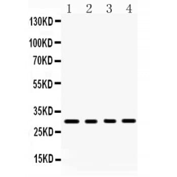 Polyclonal Rabbit anti-Human BAFF / TNFSF13B Antibody (aa134-285, WB)