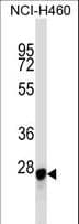 LGALS3 / Galectin 3 Antibody (aa167-196)