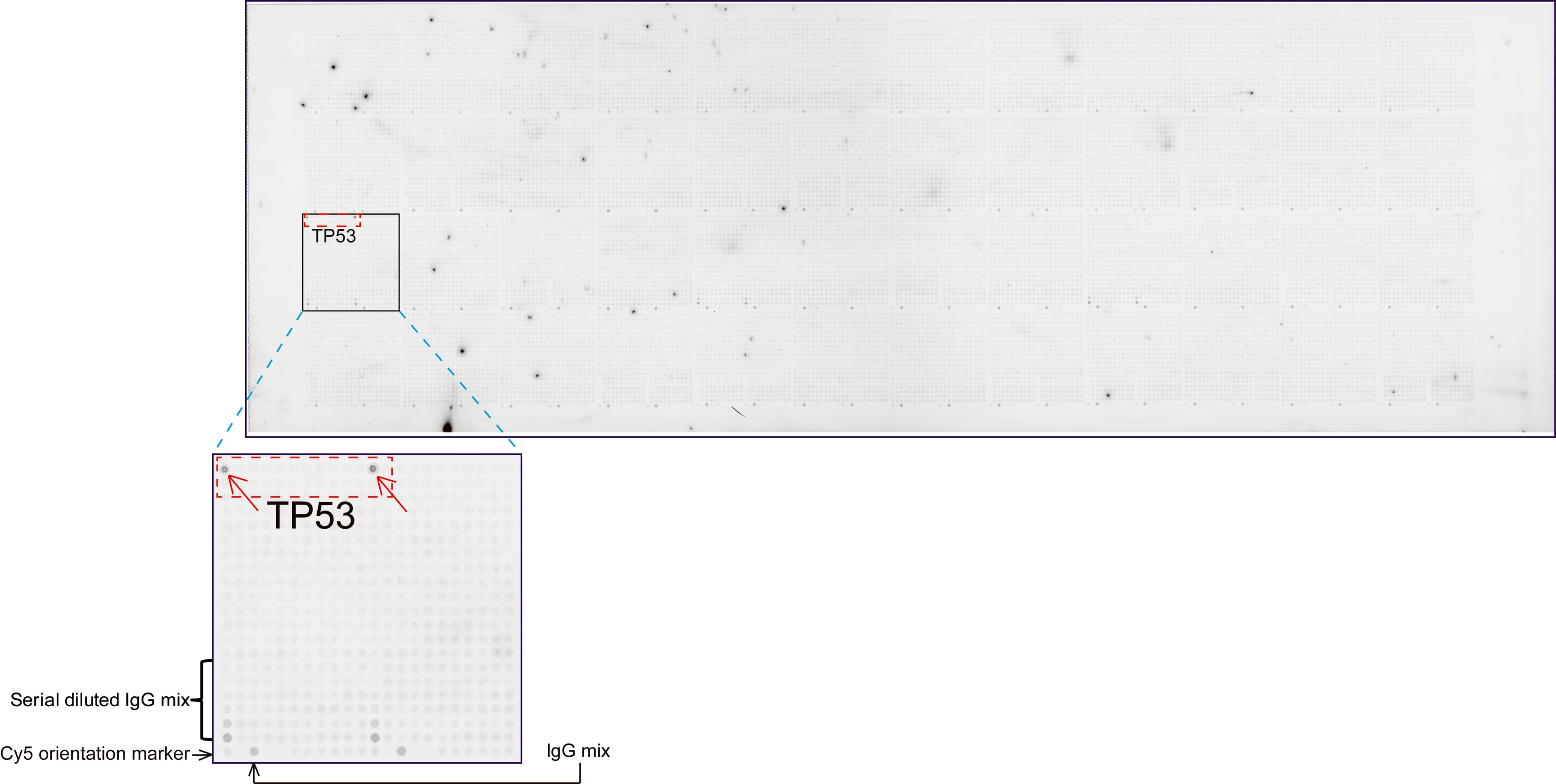 TP53 / p53 Antibody (clone UMAB206)