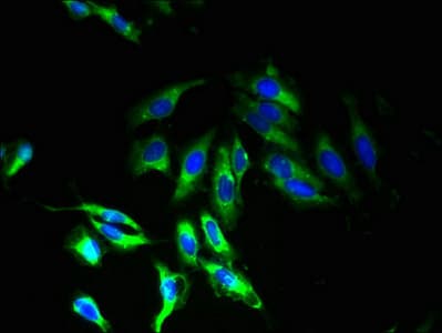 Polyclonal Rabbit anti-Human TMEM33 Antibody (IHC)