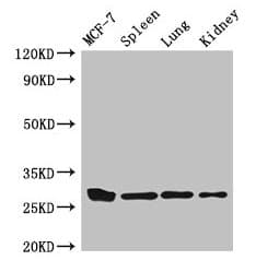 Polyclonal Rabbit anti-Human CMA1 / Mast Cell Chymase Antibody