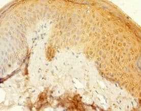 KRT77 / Keratin 77 / KRT1B Antibody (aa1-578, HRP)