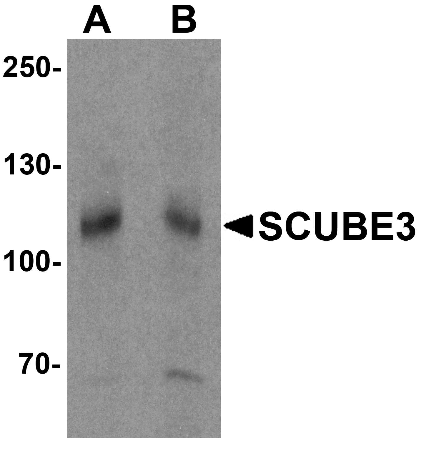 IHC-plus™ SCUBE3 Antibody