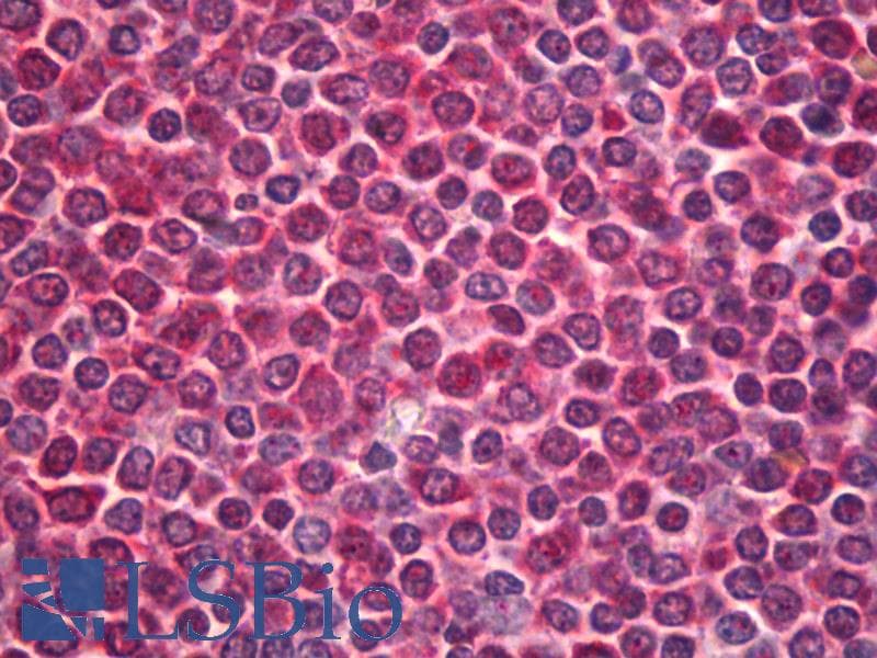 IHC-plus™ Polyclonal Rabbit anti-Human AURKB / Aurora-B Antibody (aa1-50, IHC, IF, WB)