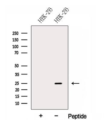Polyclonal Rabbit anti-Human GPX8 Antibody (WB)