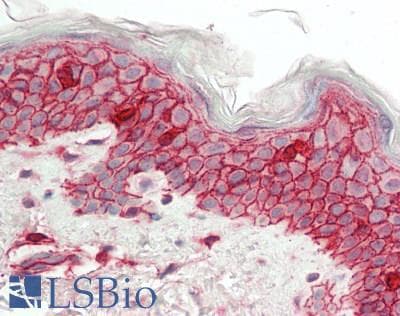 PathPlus™ B2M / Beta 2 Microglobulin Antibody