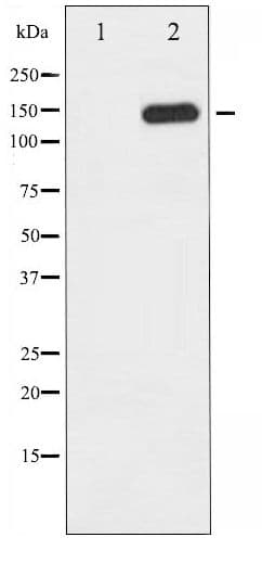 Polyclonal Rabbit anti-Human PLCG1 Antibody (phospho-Tyr783, IHC, WB)