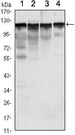 IHC-plus™ HK1 / Hexokinase 1 Antibody (clone 3A10)