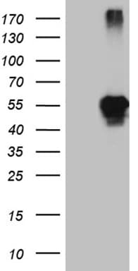LHX2 Antibody (aa220-406, clone OTI5C7)