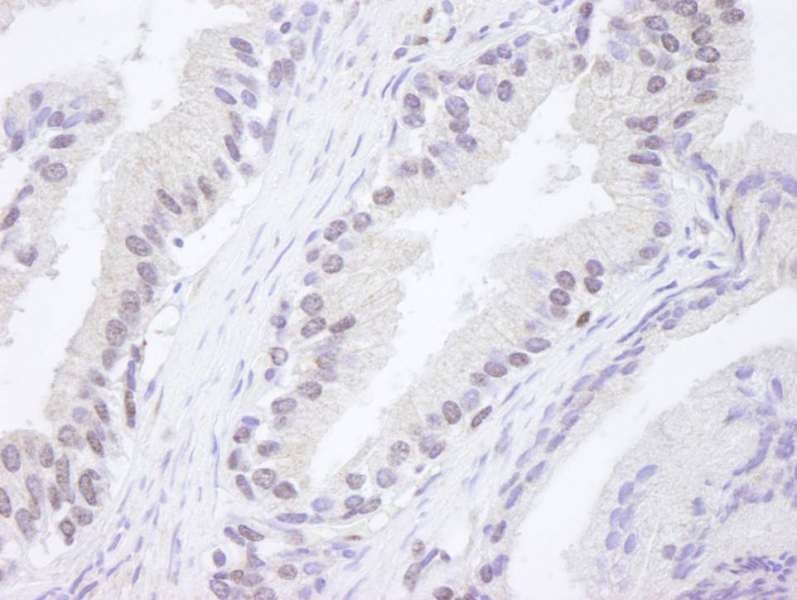 ATM Antibody (aa2550-2600)