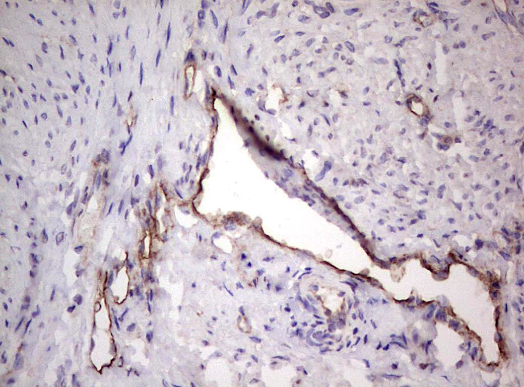 PROCR / EPCR Antibody (aa1-210, clone OTI2D11)