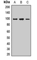 WHRN Antibody