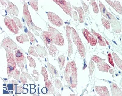 MYLK3 Antibody (aa555-786)
