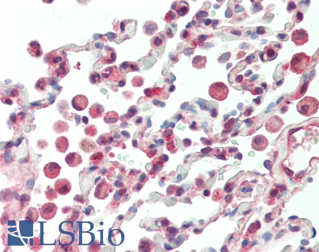 APRT Antibody (N-Terminus)