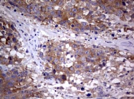 PIK3C2A Antibody (aa230-560, clone OTI2C2)