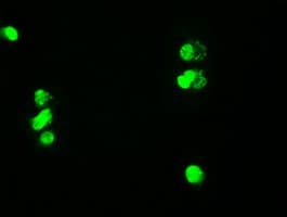 MYC / c-Myc Antibody (clone OTI5G3)