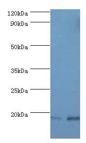 FGF1 / Acidic FGF Antibody (aa16-155)