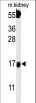 FGFBP3 Antibody (aa181-210)