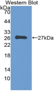 CD135 / FLT3 Antibody (aa334-543)