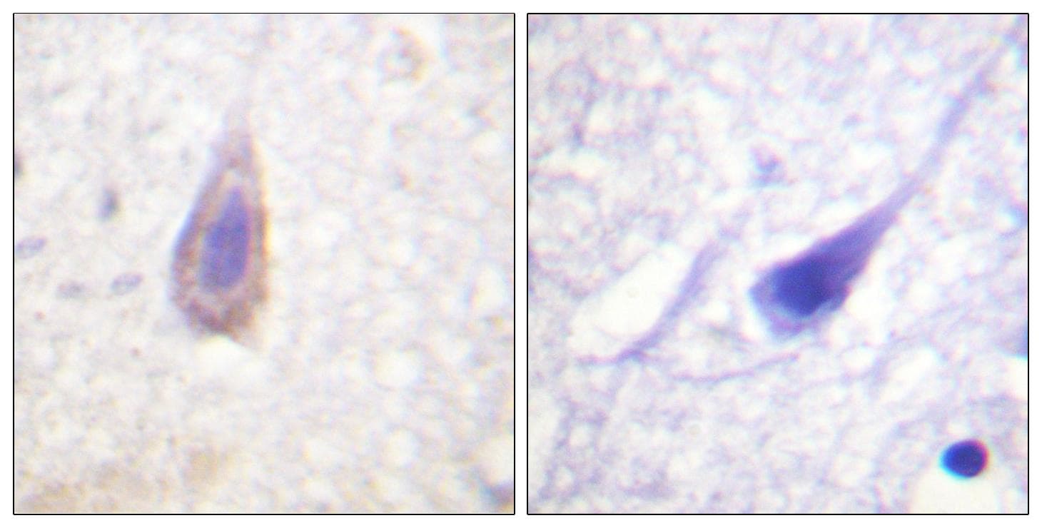 Polyclonal Rabbit anti-Human OPRD1 / Delta Opioid Receptor Antibody (p363, IHC, WB)