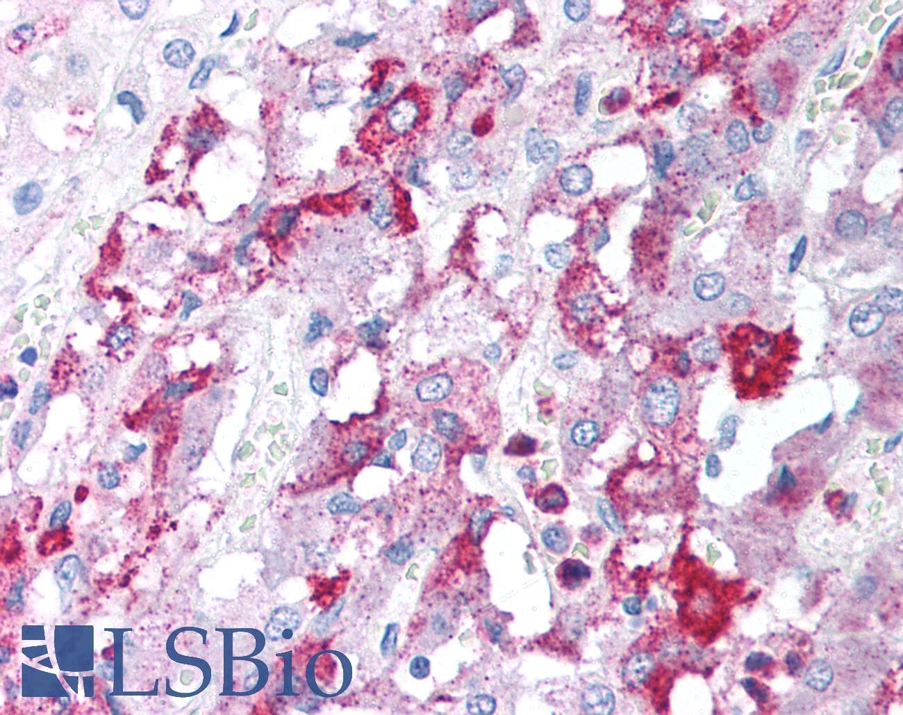 IHC-plus™ Polyclonal Rabbit anti-Human GFRA3 Antibody (IHC, IF, WB)