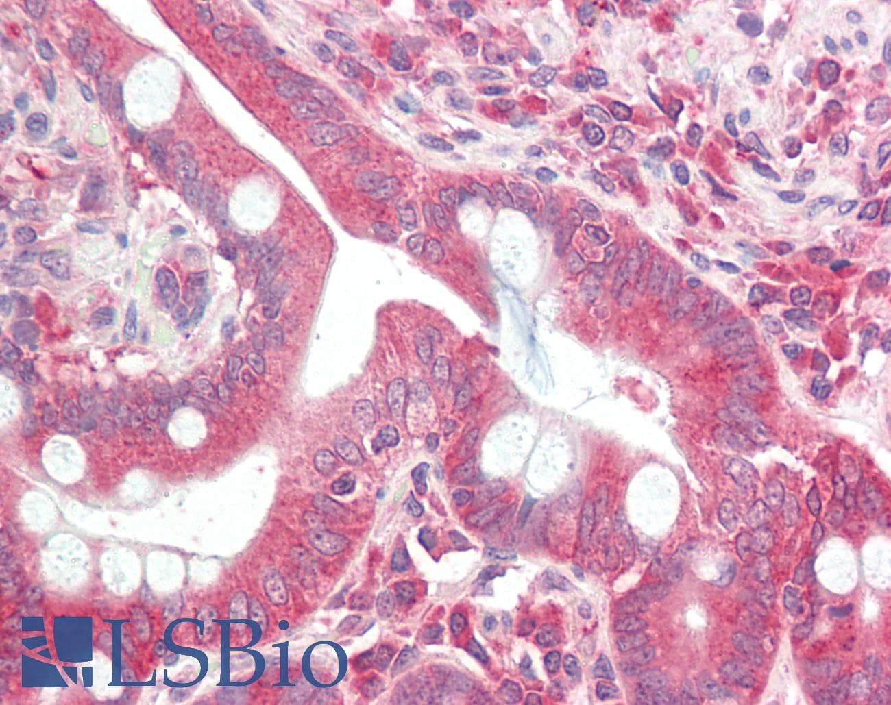 IHC-plus™ Polyclonal Rabbit anti-Human DCP2 Antibody (IHC, IF, WB)