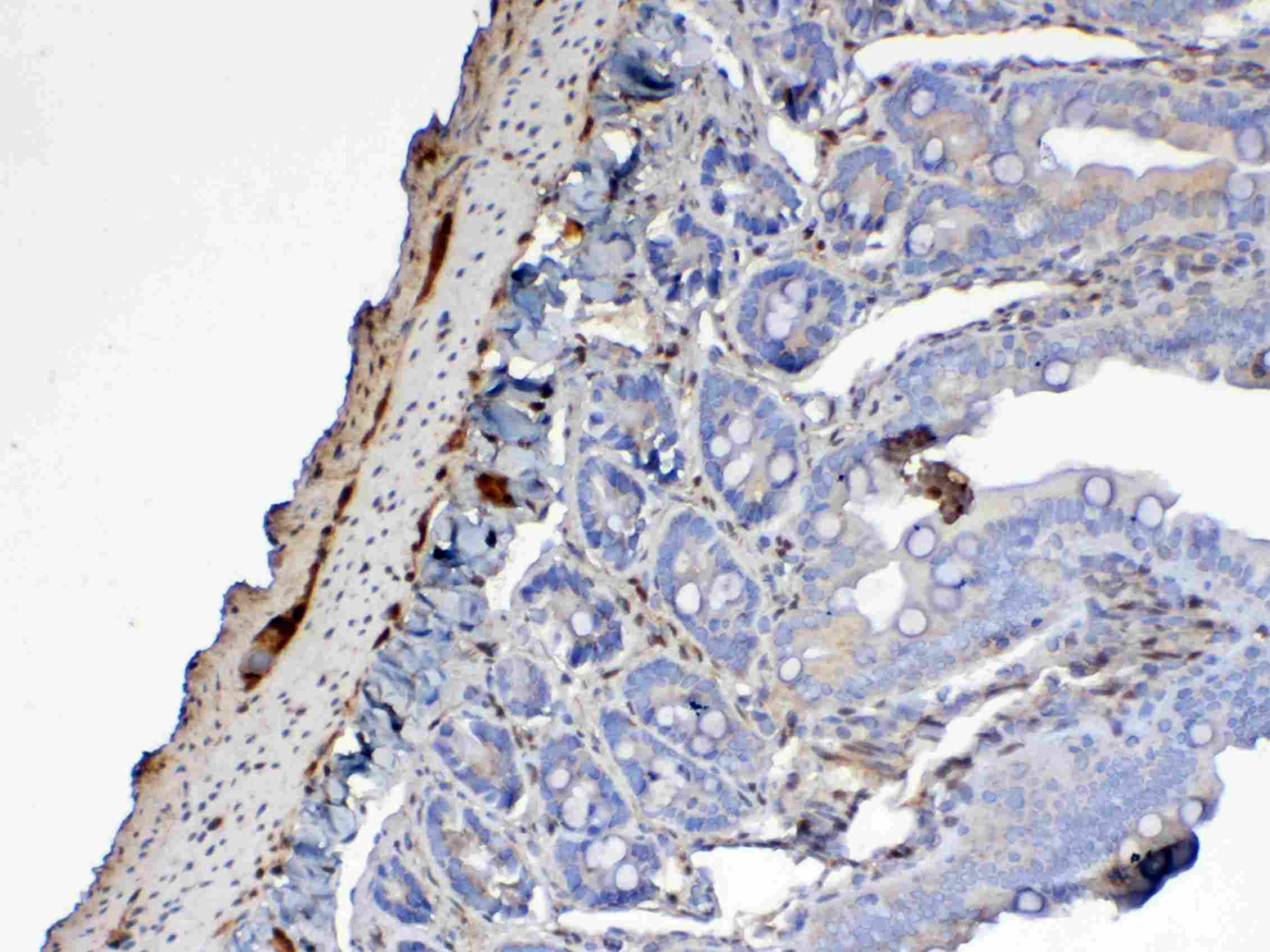 LGALS1 / Galectin 1 Antibody