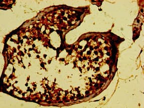 Polyclonal Rabbit anti-Human NKG2DL4 / ULBP4 Antibody (IHC)