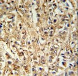 Polyclonal Rabbit anti-Human DDX6 Antibody (aa348-375, IHC, WB)