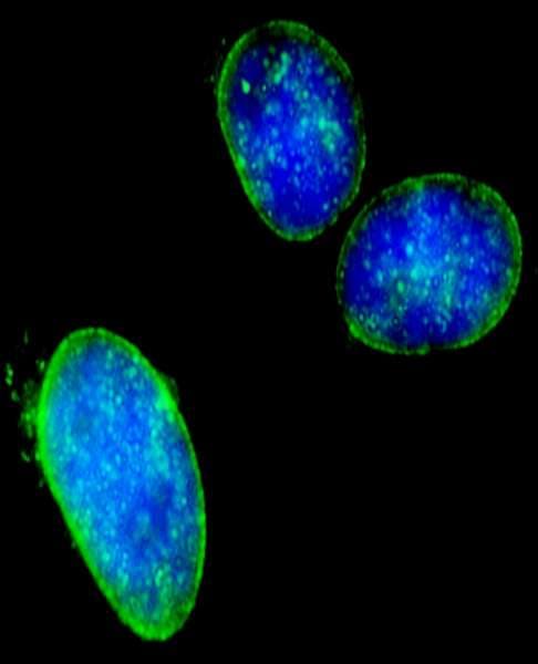 NUP214 / CAN Antibody (aa1250-1300)