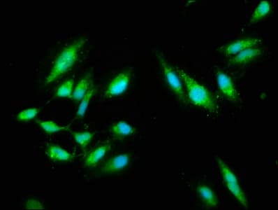 CARD14 Antibody