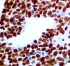 GATA3 Antibody (clone L50-823, Ready-to-Use)
