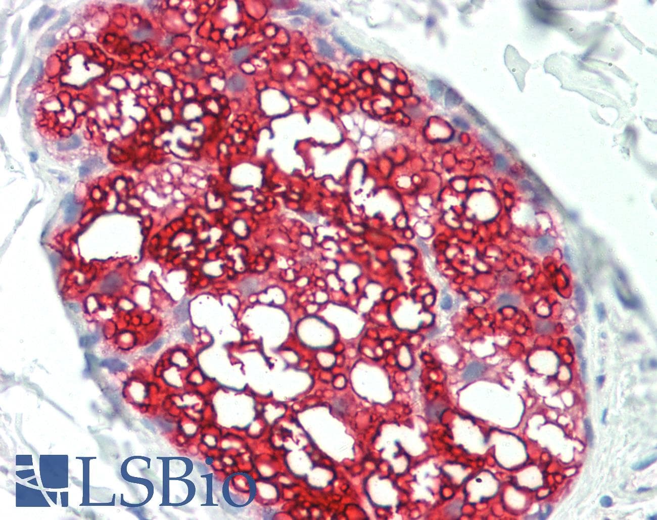 IHC-plus™ HSD3B1 Antibody (clone 3C11-D4)